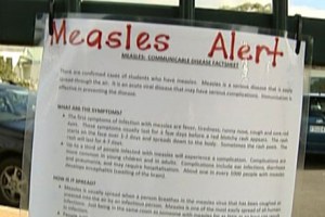 It’s been just over a year since a large measles outbreak began in Auckland, New Zealand